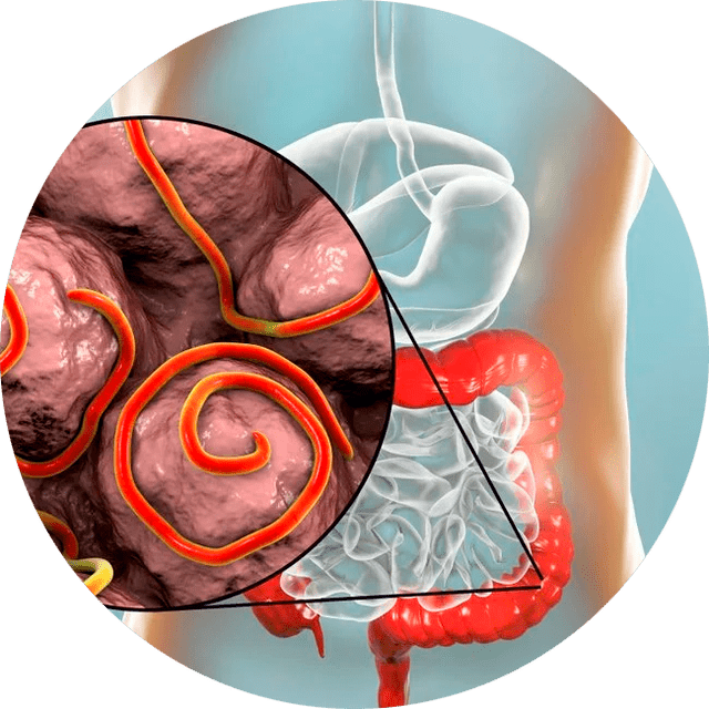 Tractus gastro-intestinal et parasites