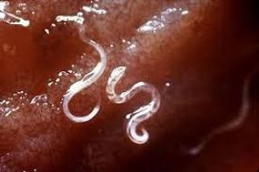 Parasites dans le corps humain