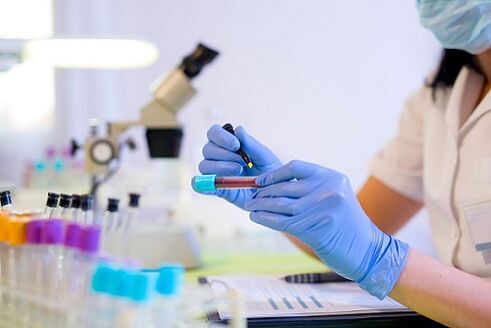 Test sanguin pour les parasites